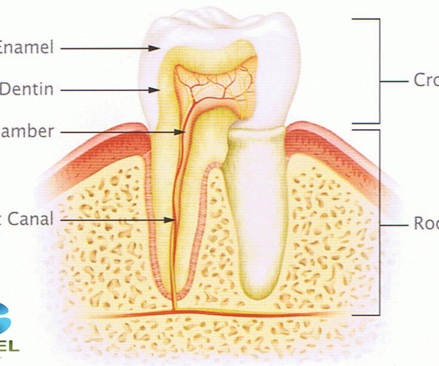 Dental Cavity