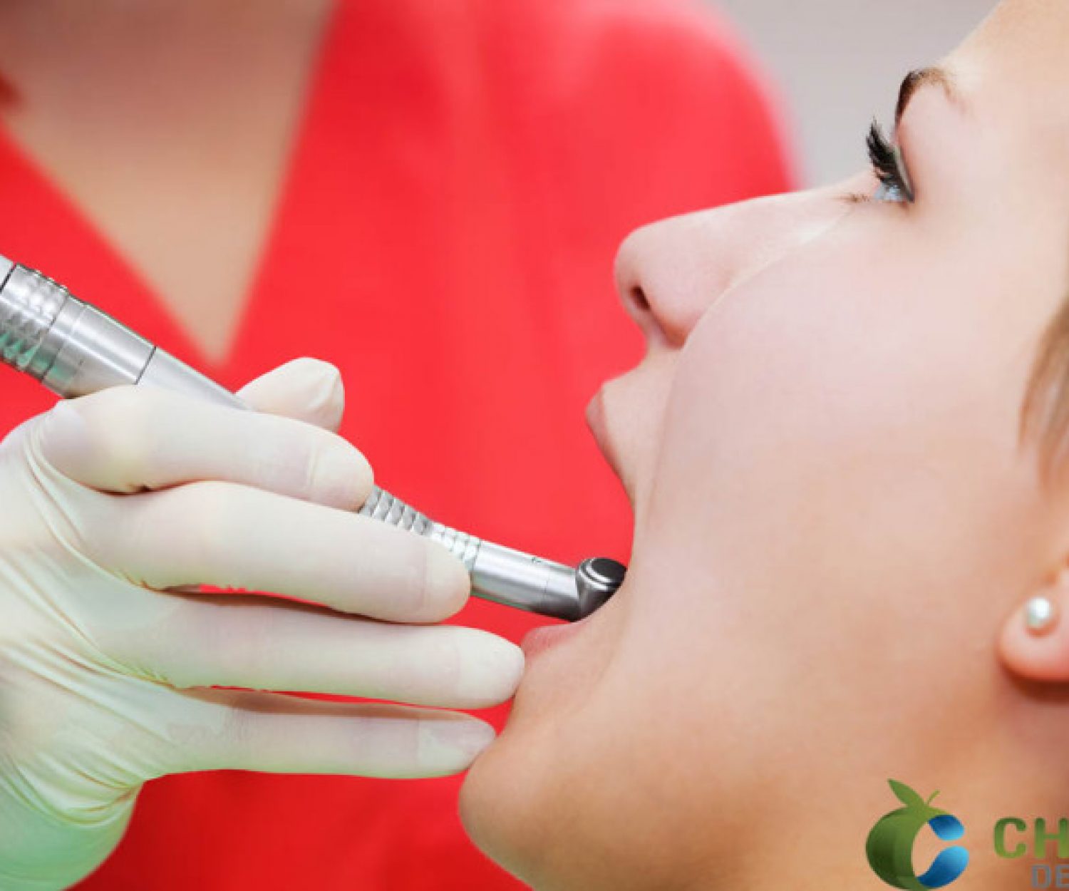 Oropharyngeal Cancer