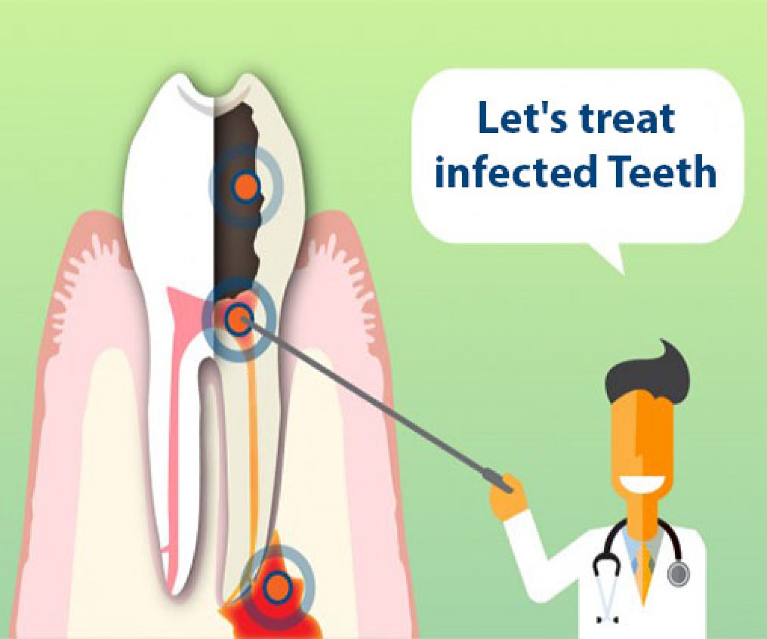 Treat Problematic Teeth with Root Canal