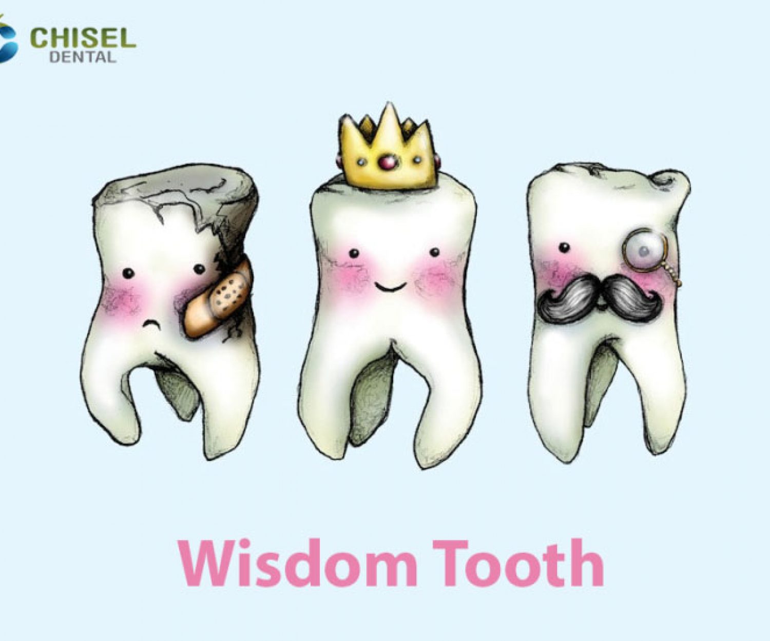 All you need to know about wisdom teeth